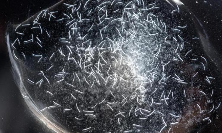 <p>With support from the National Science Foundation, Georgia Tech researchers are studying Spirostomum ambiguum, a tiny single-celled protozoan that achieves blazing-fast acceleration while contracting its worm-like body. (Credit: Rob Felt, Georgia Tech)</p>