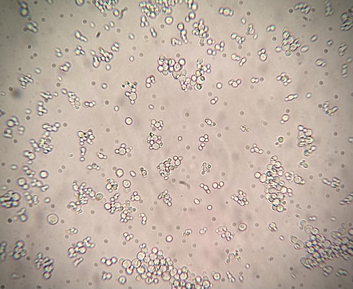 Saccharomyces cerevisiae, also known as baker's yeast or budding yeast